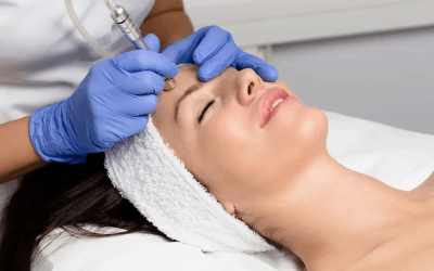 Hyperpigmentation No More: Brighten Your Skin with These Proven Facials