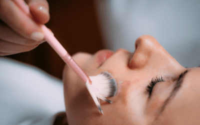 Understanding Hyperpigmentation: Why Does it Happen?