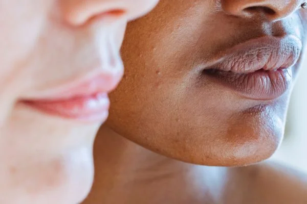 Facial Scar Treatment