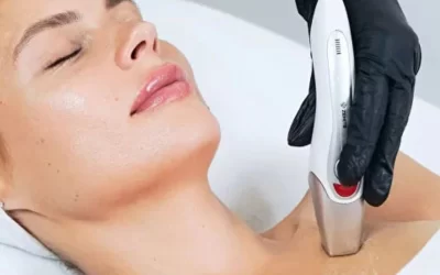 CrystalFrax for Hyperpigmentation and Texture: Before & After Results That Show the Difference