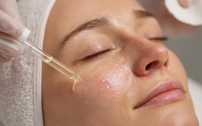 Chemical Peel Facial in Orinda: What to Expect and Why It Works